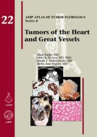 Book Cover for Tumors of the Heart and Great Vessels by Allen Burke, Fabio R Tavora, Joseph J Maleszewski, Aletta Ann Frazier