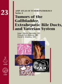 Book Cover for Tumors of the Gallbladder, Extrahepatic Bile Ducts, and Vaterian System by Jorge AlboresSaavedra, Donald Earl Henson, David S Klimstra