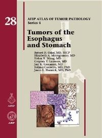 Book Cover for Tumors of the Esophagus and Stomach by Robert D Odze, Armed Forces Institute of Pathology US
