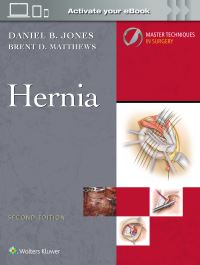 Book Cover for Master Techniques in Surgery by DANIEL B JONES, Brent D Matthews