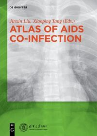 Book Cover for Atlas of AIDS Co-Infection by Jinxin Liu, Xiaoping Tang
