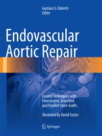 Book Cover for Endovascular Aortic Repair by Gustavo S Oderich, David Factor