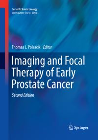 Book Cover for Imaging and Focal Therapy of Early Prostate Cancer by Thomas J Polascik