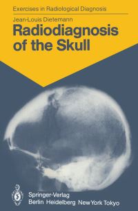 Book Cover for Radiodiagnosis of the Skull by JL Dietemann