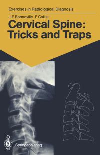 Book Cover for Cervical Spine: Tricks and Traps by JeanFrancois Bonneville, Francoise Cattin