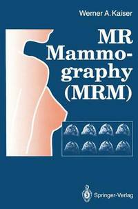 Book Cover for MR Mammography (MRM) by Werner A Kaiser