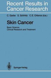 Book Cover for Skin Cancer by Claus Garbe, Stefan Schmitz, Constantin E Orfanos