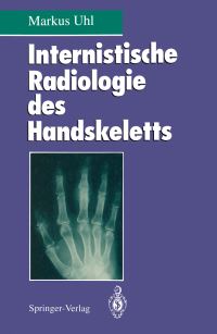 Book Cover for Internistische Radiologie Des Handskeletts by Markus Uhl