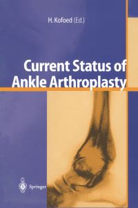 Book Cover for Current Status of Ankle Arthroplasty by Hakon Kofoed