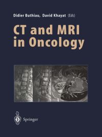 Book Cover for CT and MRI in Oncology by Didier Buthiau, JF Holland, S Buthiau, David Khayat