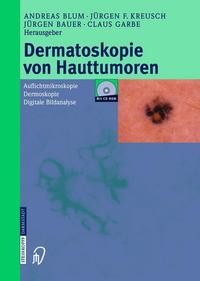 Book Cover for Dermatoskopie Von Hauttumoren by A Blum, JF Kreusch, J Bauer, C Garbe