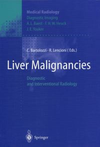 Book Cover for Liver Malignancies Diagnostic Imaging by C Bartolozzi, AL Baert, R Lencioni