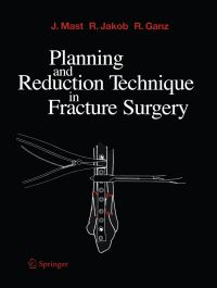 Book Cover for Planning and Reduction Technique in Fracture Surgery by Jeffrey Mast, Roland Jakob, Reinhold Ganz