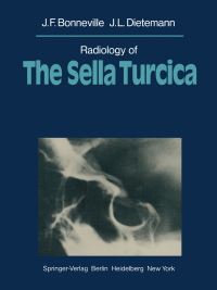 Book Cover for Radiology of The Sella Turcica by J F Bonneville, J L Dietemann