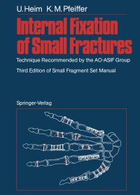 Book Cover for Internal Fixation of Small Fractures by Urs Heim, Karl M Pfeiffer