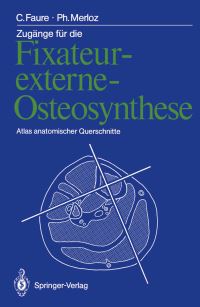 Book Cover for Zugänge Für Die Fixateur-Externe-Osteosynthese by Claude Faure, Philippe Merloz