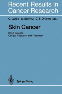 Book Cover for Skin Cancer by Claus Garbe, Stefan Schmitz, Constantin E Orfanos