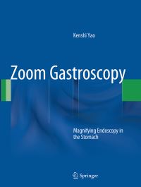 Book Cover for Zoom Gastroscopy by Kenshi Yao