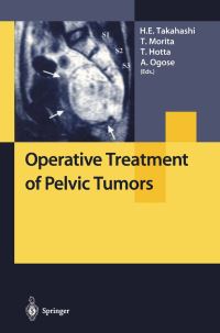 Book Cover for Operative Treatment of Pelvic Tumors by Hideaki Takahashi