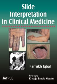 Book Cover for Slide Interpretation in Clinical Medicine by Farrukh Iqbal