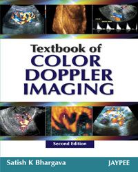 Book Cover for Textbook of Color Doppler Imaging by Satish K Bhargava