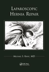 Book Cover for Laparoscopic Hernia Repair by Michael S Kavic