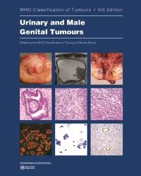 Book Cover for Urinary and Male Genital Tumours by Who Classification of Tumours Editorial Board