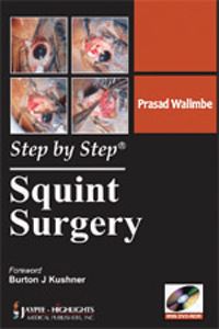 Book Cover for Squint Surgery by Prasad Walimbe