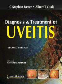 Book Cover for Diagnosis and Treatment of Uveitis by C Stephen Foster, Albert T Vitale
