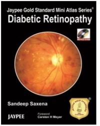 Book Cover for Diabetic Retinopathy by Sandeep Saxena