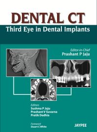 Book Cover for Dental CT Third Eye in Dental Implants by Prashant P Jaju