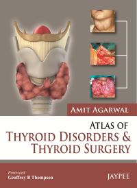 Book Cover for Atlas of Thyroid Disorders and Thyroid Surgery by Amit Agarwal