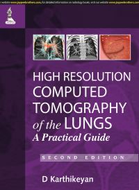 Book Cover for High Resolution Computed Tomography of the Lungs by D Karthikeyan