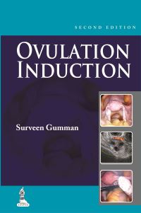 Book Cover for Step by Step Ovulation Induction by Surveen Ghumman