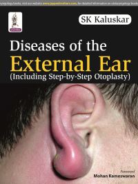 Book Cover for Diseases of the External Ear by S K Kaluskar