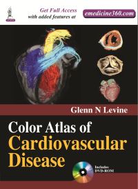 Book Cover for Color Atlas of Cardiovascular Disease by Glenn N Levine