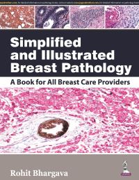 Book Cover for Simplified and Illustrated Breast Pathology by Rohit Bhargava