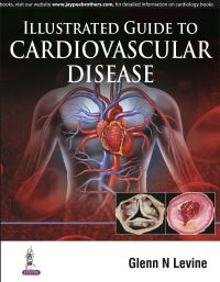 Book Cover for Illustrated Guide to Cardiovascular Disease by Glenn N Levine