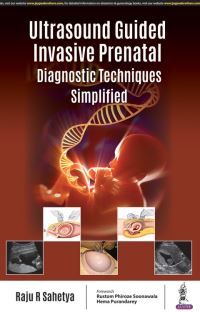 Book Cover for Ultrasound Guided 'Invasive Prenatal Diagnostic Techniques' Simplified by Raju R Sahetya