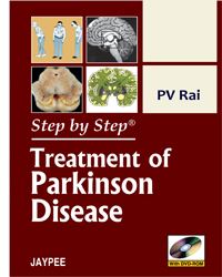 Book Cover for Step by Step Treatment of Parkinson Disease by P V Rai