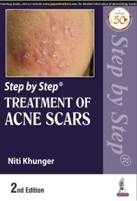 Book Cover for Step by Step Treatment of Acne Scars by Niti Khunger