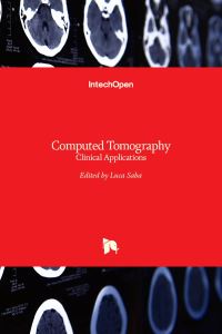 Book Cover for Computed Tomography by Luca Saba