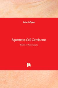 Book Cover for Squamous Cell Carcinoma by Xiaoming Li