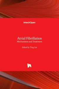 Book Cover for Atrial Fibrillation by Tong Liu