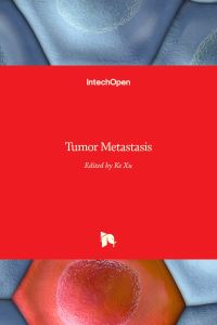 Book Cover for Tumor Metastasis by Ke Xu