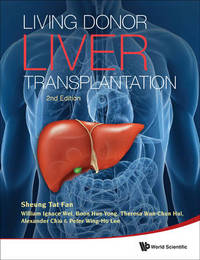 Book Cover for Living Donor Liver Transplantation by Sheung Tat Fan