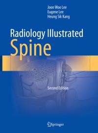 Book Cover for Radiology Illustrated. Spine by Heung Sik Kang, Joon Woo Lee, Jong Won Kwon