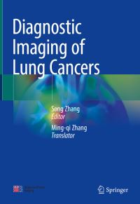 Book Cover for Diagnostic Imaging of Lung Cancers by Song Zhang