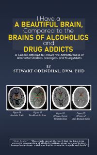 Book Cover for I Have a Beautiful Brain, Compared to the Brains of Alcoholics and Drug Addicts by DVM, PhD, Stewart Odendhal