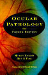 Ocular pathology